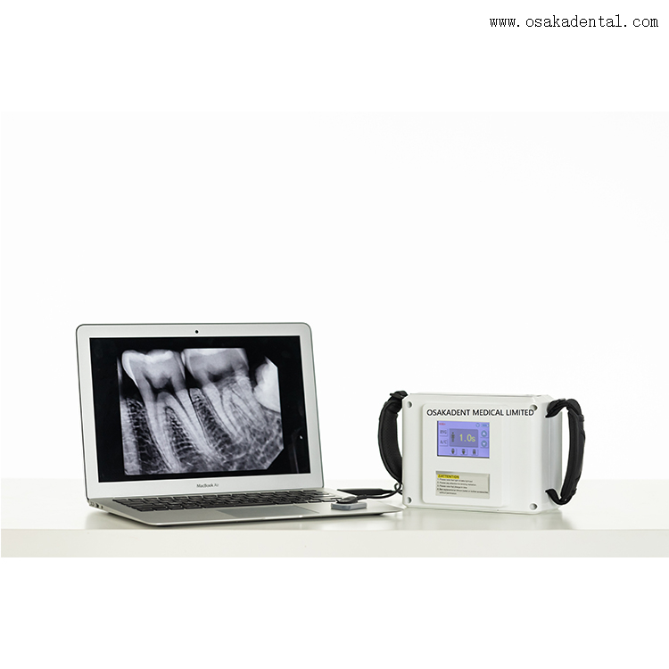 Dental Equipment Dental Portable X Ray Unit Buy Dental Portable X Ray
